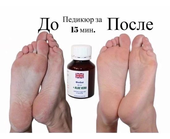 РЕМУВЕР BIOGEL, код 4238006